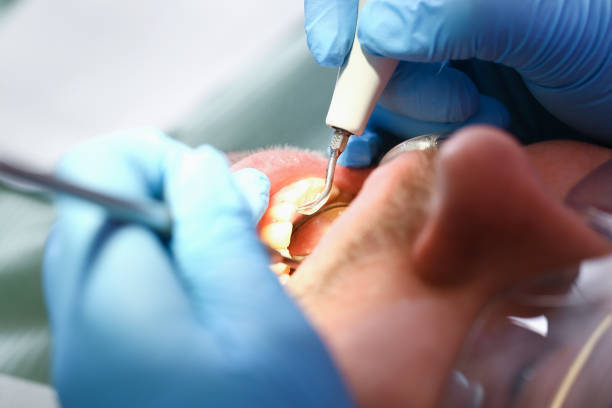 Best Cracked Tooth Emergency Dentist  in West Cape May, NJ